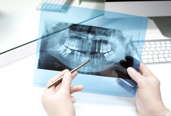 Digital X Ray