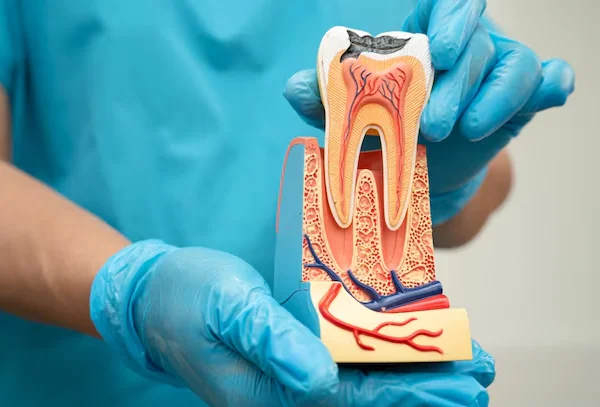 Root Canal Treatment