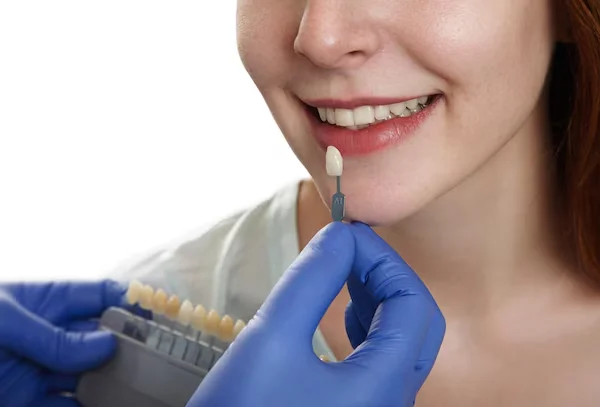 Zirconia and Emax Crowns