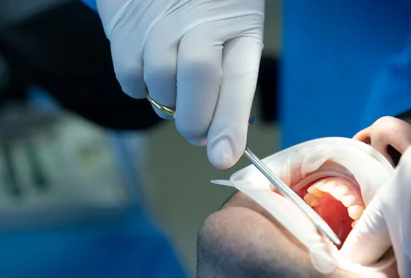 Gum Surgeries